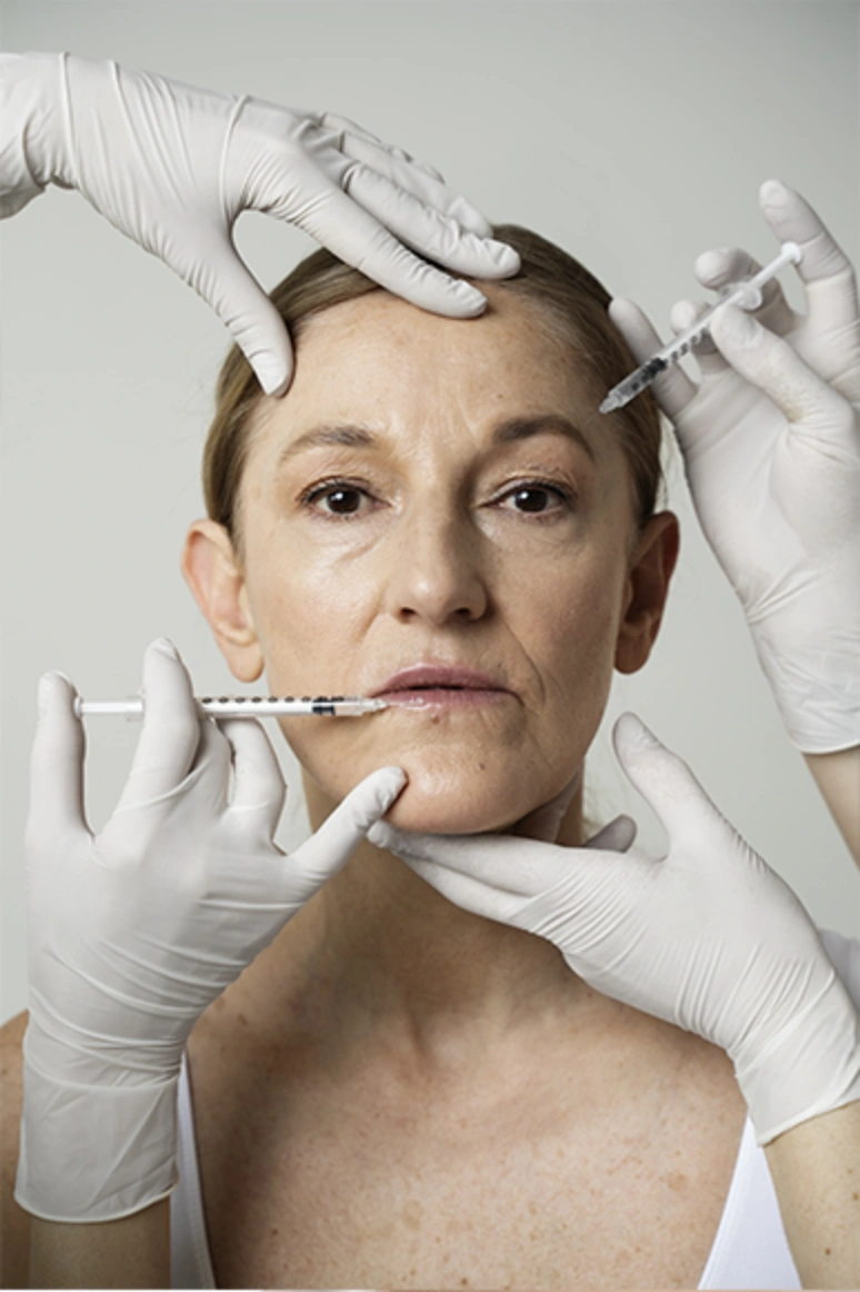 bioestimuladores-de-colageno-estetica-avancada